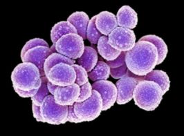 Staphylococcus aureus