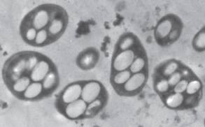cells with large vacuoles