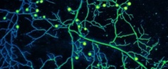The exchange of material between plants and fungi converted Earth's early rock into soil