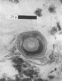 Large virus-like particle