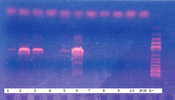 Bacterial DNA in cosmic dust at the International Space Station
