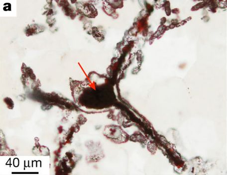 Filaments from the NSB attached to a terminal knob