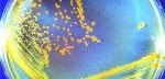Germs survive in space