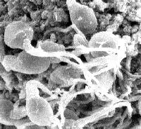 Human sperm cells and ovum surface