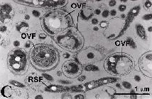 TEM micrograph of developing nanobacteria